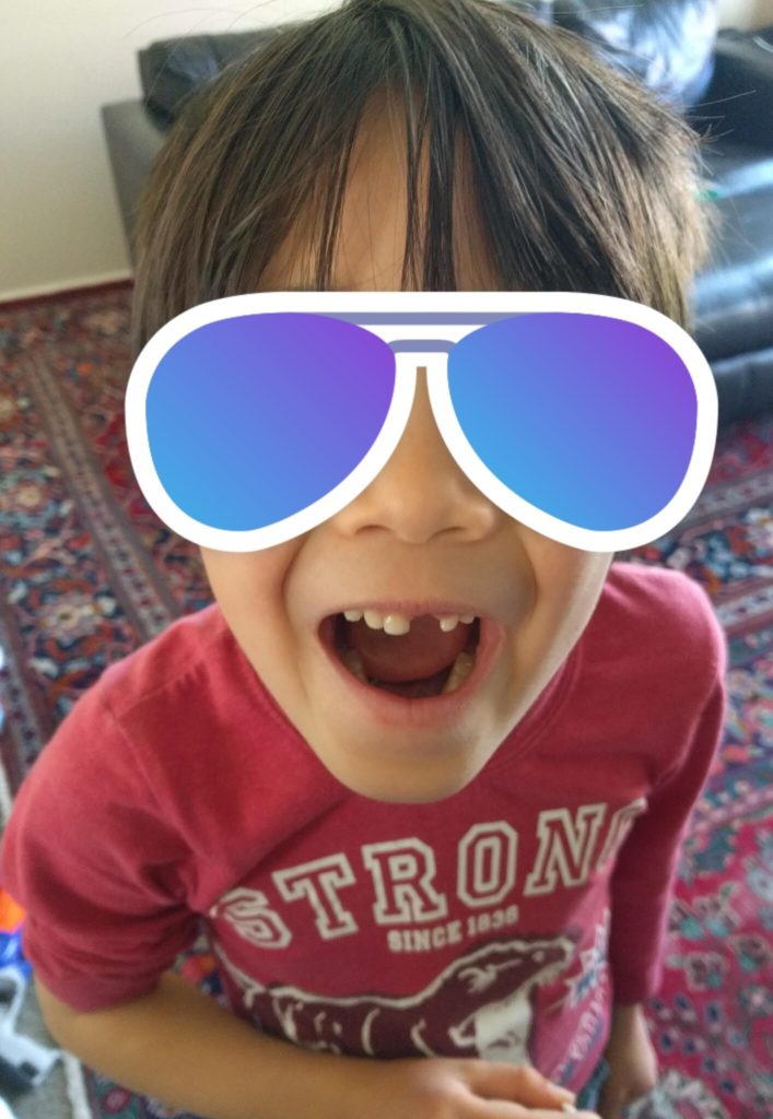 歯が抜けた息子